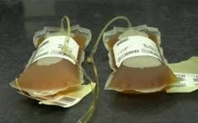 Estados Unidos suspende tratamiento con plasma en pacientes con coronavirus