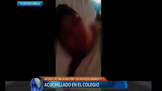 Habló el joven apuñalado por otro estudiante en la escuela: "Nadie me auxilió"