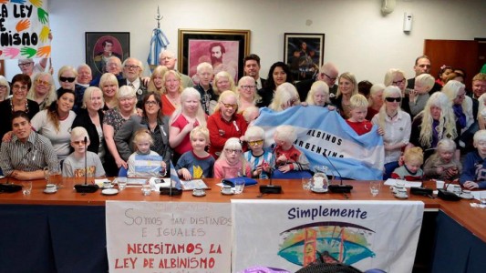 Albinismo: curiosidades, discriminación y un proyecto de ley esperanzador