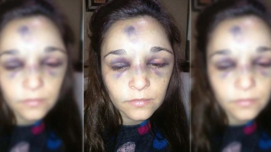 Está muy grave una mujer que fue golpeada por su pareja, un boxeador de 17 años
