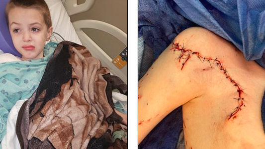 Un nene de 9 años fue atacado por un tiburón en Miami