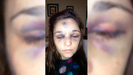 Murió una mujer tras la brutal golpiza de su novio de 17 años