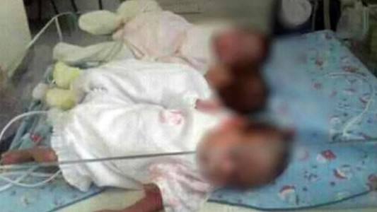 El estado de salud de las trillizas que buscan hogar: "Lo único que necesitan es cariño"