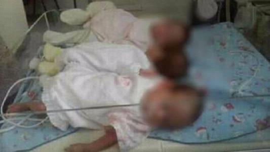 Las trillizas de San Justo volvieron con su madre y viven en un hogar sustituto