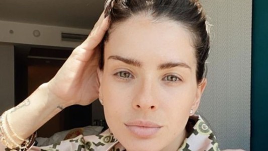 Tras superar el Covid-19, la "China" Suárez reveló que padece cáncer de piel