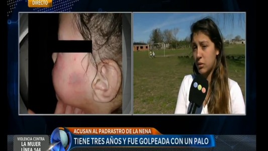 Acusan a un hombre de golpear a su hijastra y maquillarla para cubrir las marcas