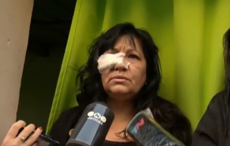 Vecina del Barrio Padre Mugica denunció que los narcos le habían usurpado la casa: fue apuñalada en un ojo