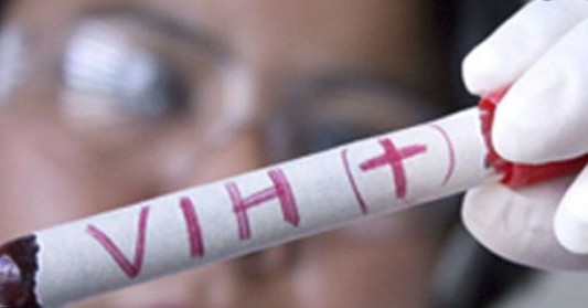 "En la Argentina el 17% de las personas que viven con VIH no lo saben", sostiene el Dr. Cahn