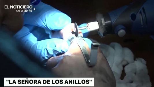 "La señora de los anillos"