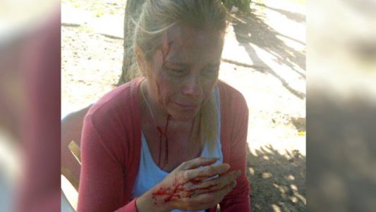 Fue al cementerio a visitar la tumba de su mamá, quisieron robarle y la agredieron brutalmente