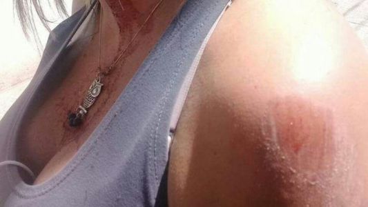 Atropellaron a su hija y encima le dieron una paliza