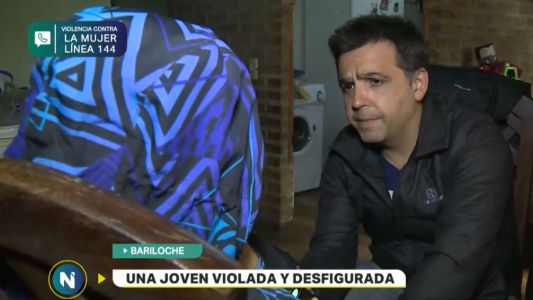 El desgarrador testimonio de la joven violada y desfigurada en Bariloche: “Me pegó hasta que perdí el conocimiento”