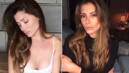 Millonaria multa a modelo por promover una dieta con ayuno de varias semanas