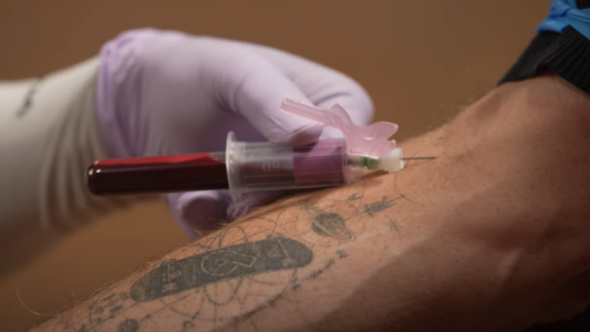 Venden patinetas con sangre real de Tony Hawk, leyenda del skate