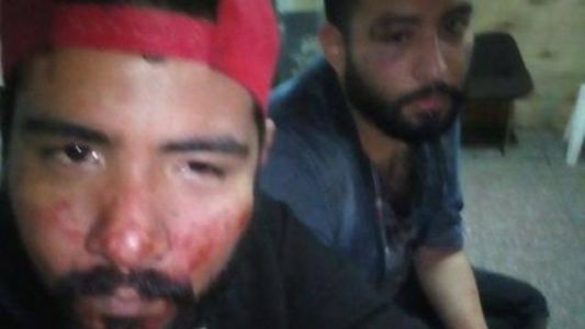 Feroz paliza a una pareja gay en Quilmes