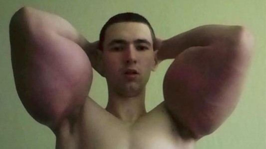 La historia detrás del "popeye ruso": le explotaron los brazos tras una pelea de MMA