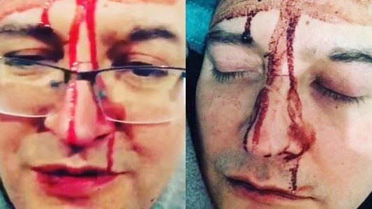 Leo García denunció que lo atacaron por su sexualidad: "La homofobia no para más"