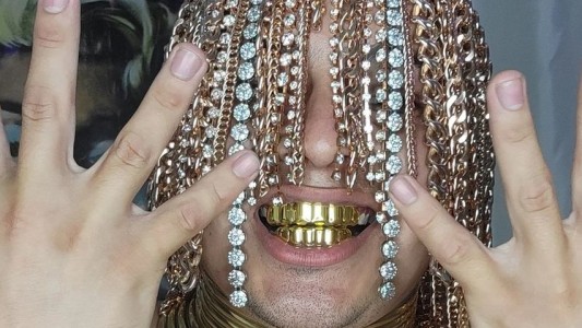Rapero se implantó cadenas de oro como pelo: "Quería hacer algo diferente"