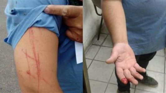 Otro ataque a un colectivero: acuchillaron a un chofer en Pablo Podestá