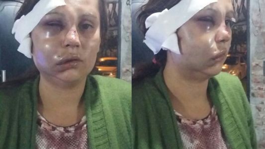Denunció que su pareja la golpeó y escapó