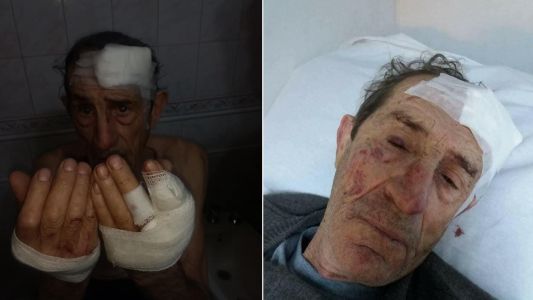 Brutal entradera a un jubilado: "Serrucharon sus manos y sus dedos"