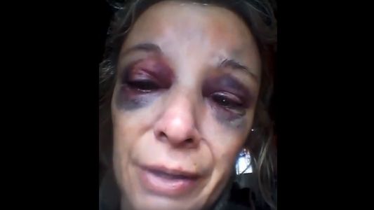 El desgarrador pedido de ayuda de una mujer a la que le pegaron un ladrillazo por negarse a tener sexo