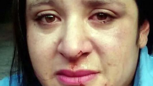 Brutal paliza de un pasajero a una colectivera salteña