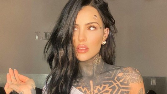 Cande Tinelli se operó la nariz y mostró su nueva cara: "La tenía más corrida que la torre de Pisa"