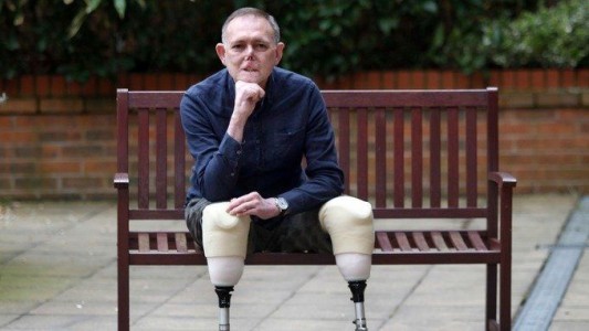 El hombre al que le amputaron las piernas y se le desfiguró la cara tras un arañazo de su perro