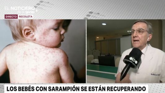 Alerta por sarampión: se confirmaron dos casos en Buenos Aires