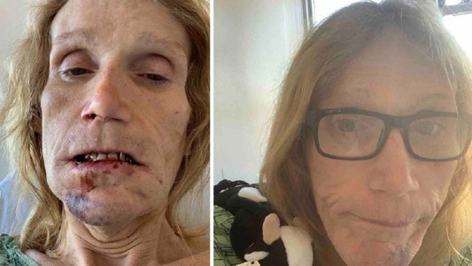 Una mujer trans fue detenida en una cárcel de hombres: le rompieron la mandíbula y tardaron 12 horas en atenderla