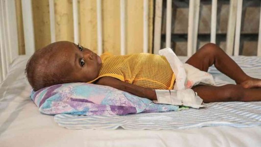 Unos 200 niños murieron de hambre en hospitales de Etiopía