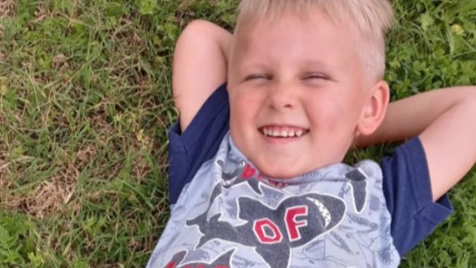 Nene perdió un brazo completo tras intentar acariciar a un perro pitbull en la casa de sus abuelos