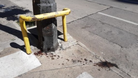 Le amputaron una pierna a una adolescente que fue acosada y atropellada