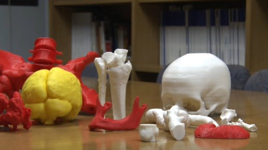 En la Favaloro operaron por primera vez con un órgano impreso en 3D como referencia