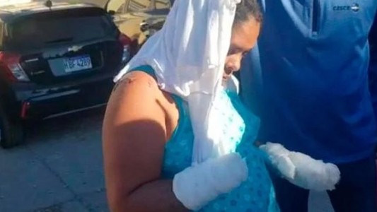 Con un machete, le cortó las manos a una mujer casada que no quería salir con él