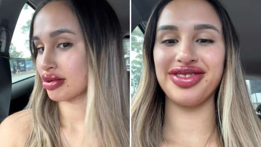 Le ofrecieron un tatuaje de labios gratis, mostró el resultado el TikTok y se volvió viral