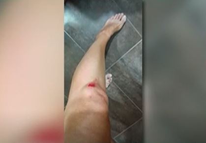 Video: Una docente iba con su hijo de 13 años y la atropellaron cuando se resistió a un asalto