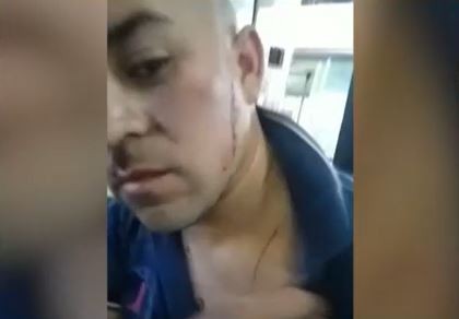 Le cortaron la cara a un colectivero de la línea 325 para robarle