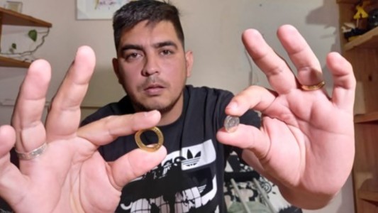 Un ladrón le disparó y se salvó gracias a una moneda de $2