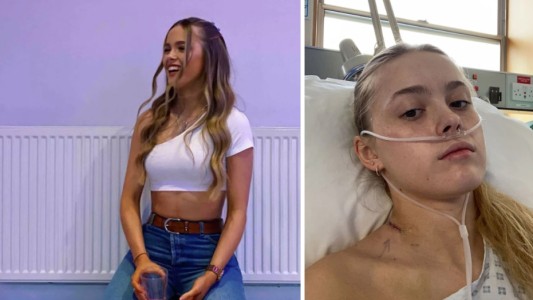 "Acidez estomacal por consumo de alcohol": médicos le dieron un diagnóstico erróneo y la joven pelea por su vida