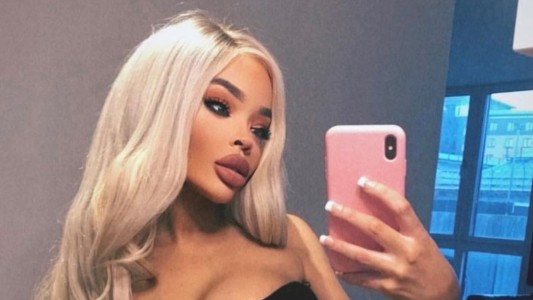 Para parecerse a un filtro de Instagram, gastó 20.000 euros en cirugías