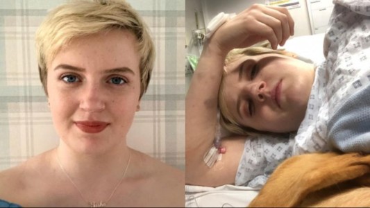 La joven que no puede ni reír ni llorar: "Soy alérgica a las emociones fuertes"