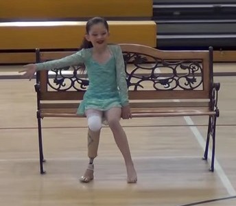 Una niña vuelve a bailar tras la amputación de su pierna