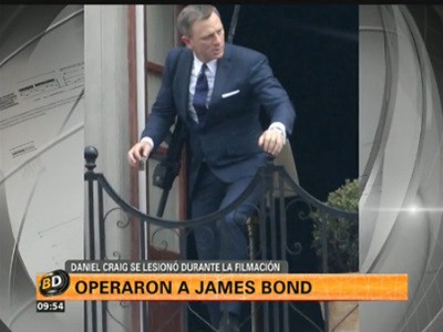 Operaron a James Bond