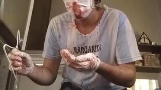 Atendieron de urgencia a un hombre que quiso hacerse una rinoplastía siguendo un tutorial de Youtube