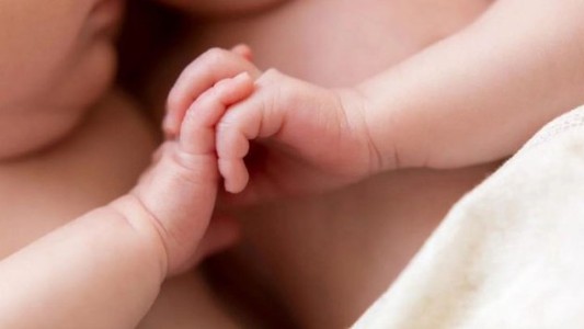 Nacieron bebas siamesas en Córdoba: "Están estables"