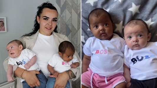 "Me preguntan si ambos son míos": dio a luz gemelos con distinto color de piel