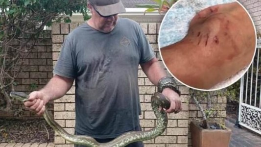 Niño sobrevivió a una pitón que lo mordió y lo arrastró a una piscina