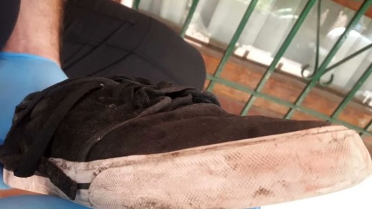 Una de las lesiones de Fernando es compatible con la zapatilla de Thomsen